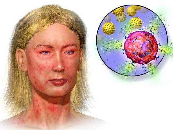 bąblowice i objawy ich obecności w organizmie