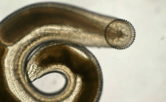 podskórny gnathostoma pasożyta
